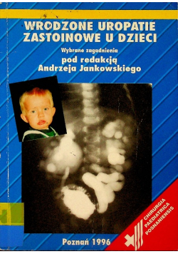 Wrodzone Uropatie Zastoinowe U Dzieci