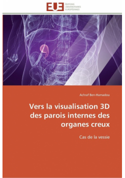 Vers la visualisation 3d des parois internes des organes creux