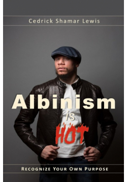Albinism is Hot!