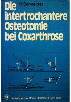 Die intertrochantere osteotomie