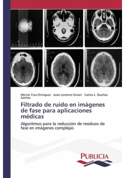 Filtrado de ruido en imágenes de fase para aplicaciones médicas