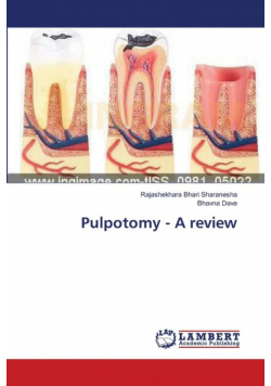Pulpotomy - A review