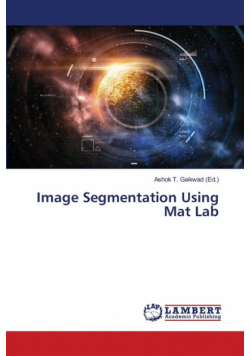 Image Segmentation Using Mat Lab
