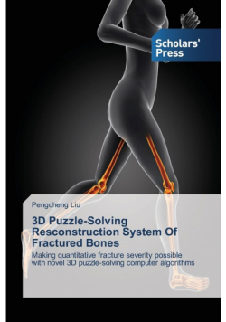 3D Puzzle-Solving Resconstruction System of Fractured Bones