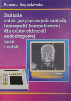 Badanie zatok przynosowych metodą tomografii komputerowej Dedykacja Bogusławskiej