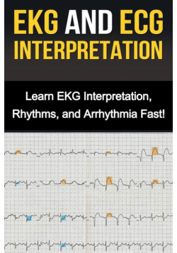 EKG and ECG Interpretation