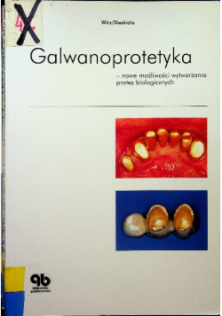 Galwanoprotetyka