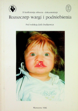 Rozszczep wargi i podniebienia
