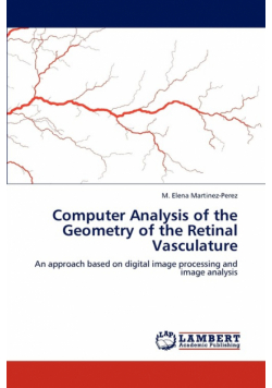 Computer Analysis of the Geometry of the Retinal Vasculature