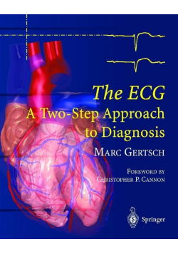 The ECG A Two Step Approach to Diagnosis