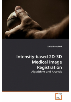 Intensity-based 2D-3D Medical Image Registration