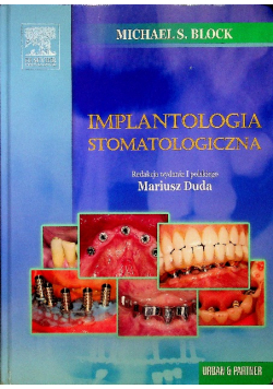 Implantologia stomatologiczna