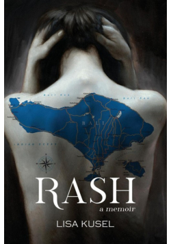 Rash