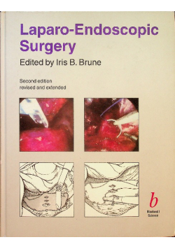 Laparo Endoscopic Surgery