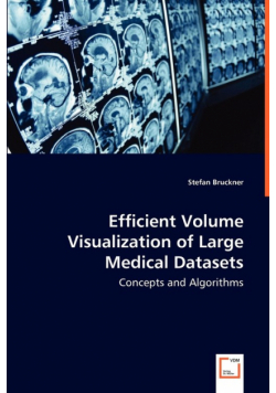 Efficient Volume Visualization of Large Medical Datasets - Concepts and Algorithms