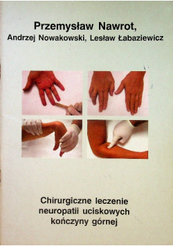 Chirurgiczne leczenie neuropatii uciskowych kończyny górnej