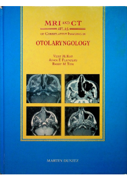 Mri and ct of correlative imaging in otolaryngology