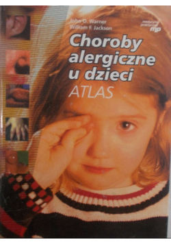 Choroby alergiczne u dzieci