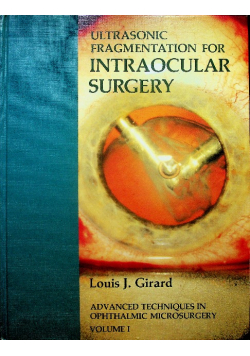 Advanced Techniques in Ophthalmic Microsurgery volume 1