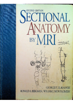 Sectional Anatomy By MRI