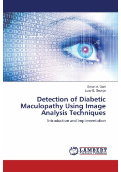 Detection of Diabetic Maculopathy Using Image Analysis Techniques