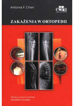Zakażenia w ortopedii