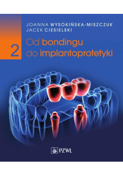 Od bondingu do implantoprotetyki. Cz. II