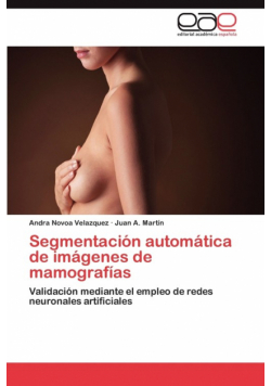 Segmentación automática de imágenes de mamografías