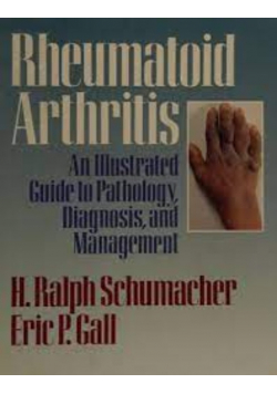 Rheumatoid Arthritis An Illustrated Guide to Pathology, Diagnosis and Management