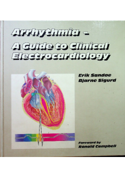 Arrhythmia A Guide To Clinical Electrocardiology