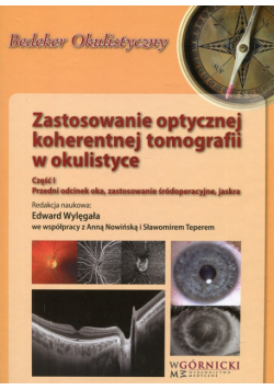 Zastosowanie optycznej koherentnej tomografii w okulistyce Część 1