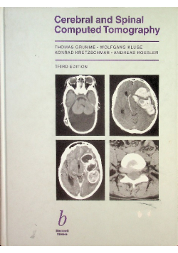 Cerebral and Spinal Computed Tomography
