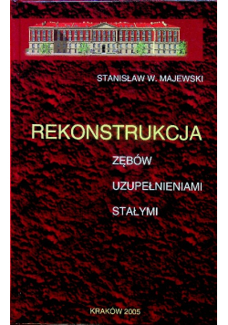 Rekonstrukcja zębów uzupełnieniem stałym