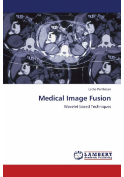 Medical Image Fusion