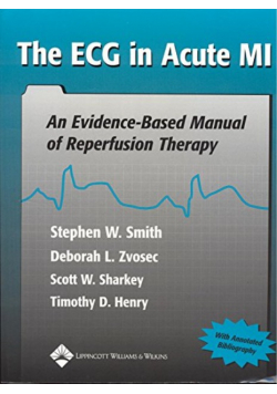 The ECG in Acute MI An Evidence Based Manual of Reperfusion Therapy