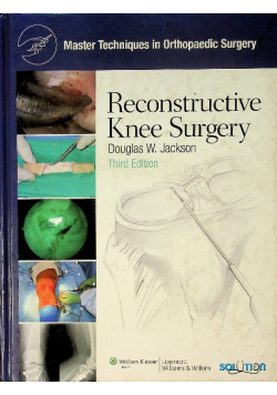 Reconstructive Knee Surgery