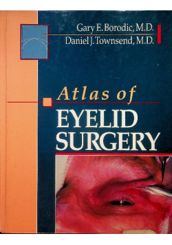 Atlas of Eyelid Surgery