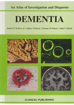 Dementia an Atlas of Investigation and Diagnosis
