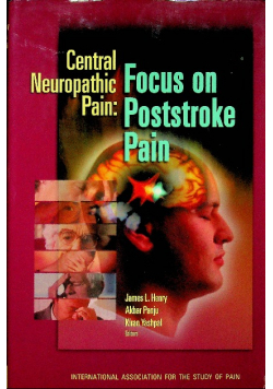 Central Neuropathic Pain Focus on Poststroke Pain