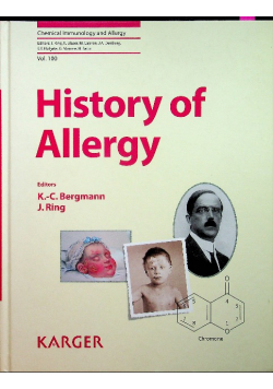 History Of Allergy Bergmann