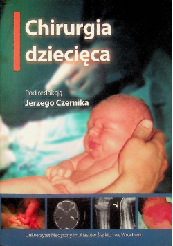 Chirurgia dziecięca
