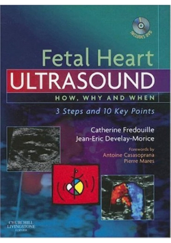 Fetal Heart Ultrasound