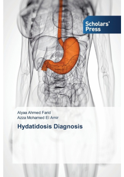 Hydatidosis Diagnosis