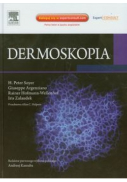Dermoskopia