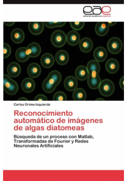 Reconocimiento Automatico de Imagenes de Algas Diatomeas