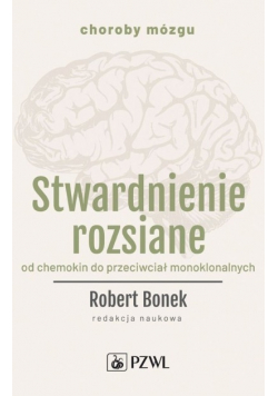 Stwardnienie rozsiane