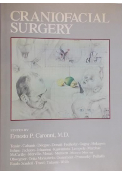 Craniofacial Surgery