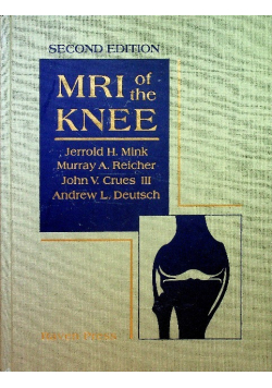 MRI of the Knee