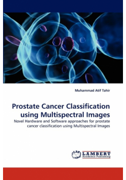 Prostate Cancer Classification using Multispectral Images