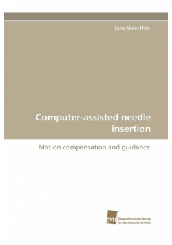 Computer-Assisted Needle Insertion